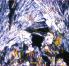 5. Ferrum phosphate 12X